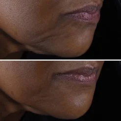 Smart Clinical Repair™ Lifting Face + Neck Cream liftingujący krem do twarzy i szyi 50ml